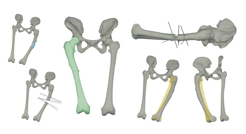 Insight Surgery raises $2.5m investment to scale FDA-cleared personalized orthopedic surgery across US