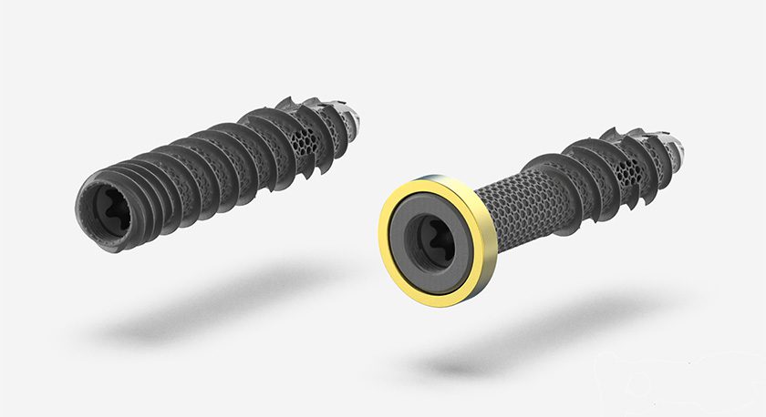 Nexxt Spine NEXXT MATRIXX SI Sacroiliac Joint Fusion