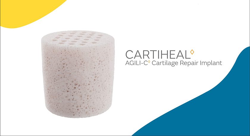 Smith+Nephew CartiHeal AGILI-C
