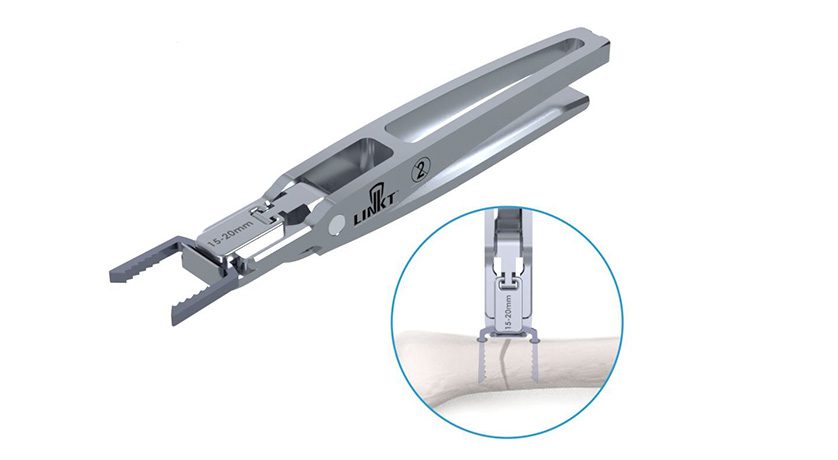 Trax Surgical LINKT Compression Staple
