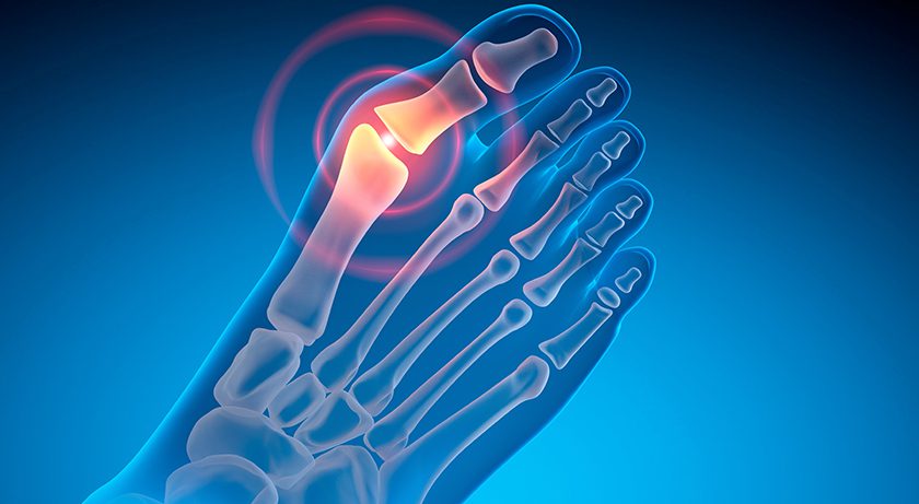 bunion pain foot and ankle