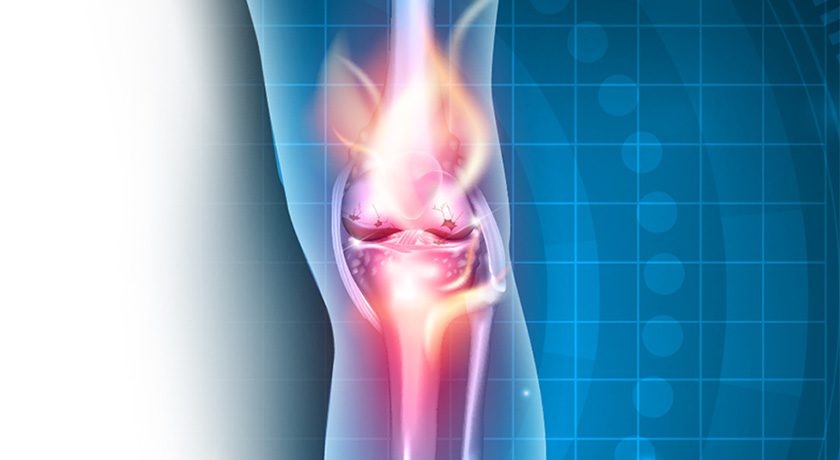 Doron Therapeutics Provides Update on MOTYS for Knee OA