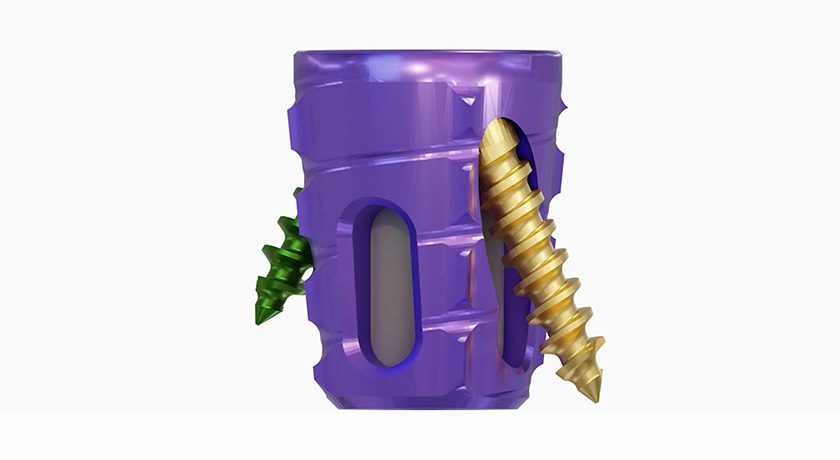 Aurora Spine SiLO TFX System