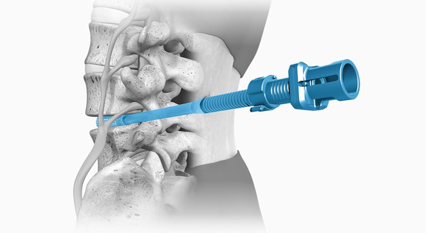Spineology OptiMesh Align