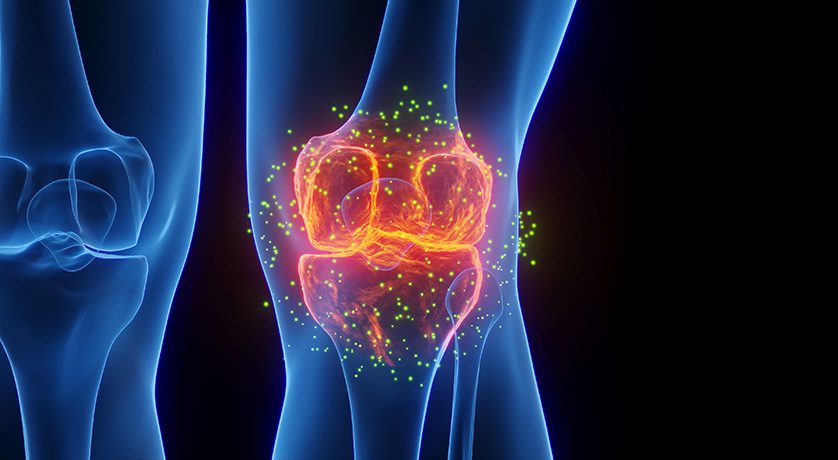 Carisma Therapeutics and OrthoCellix Partner on Cell Therapies for Orthopedic Disease