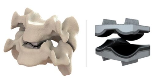 Dymicron Triadyme Cervical Disc