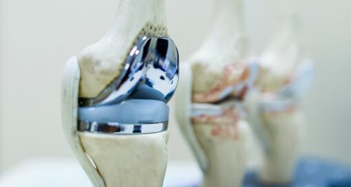 ForCast Orthopedics Reaches Initial Close of Series A Financing Round
