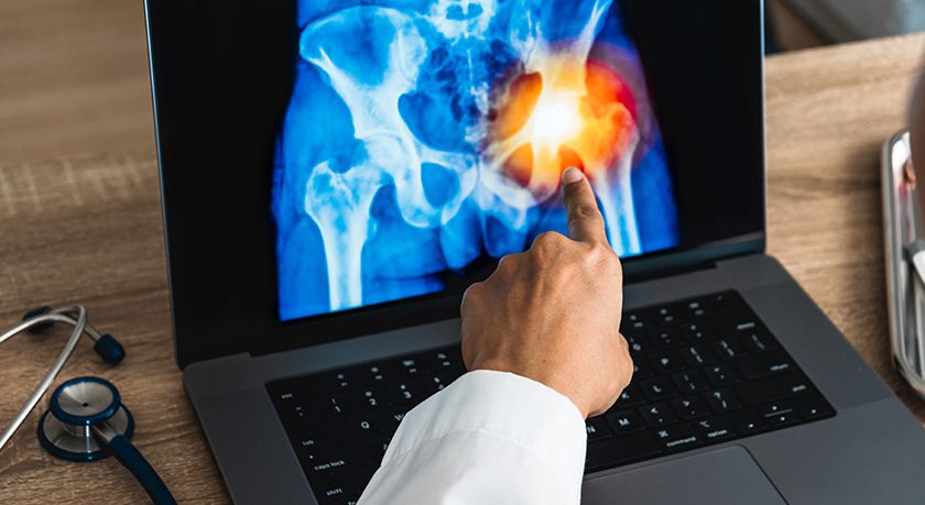 Zimmer Biomet Announces Japan PMDA Approval of World's First Iodine-Treated Total Hip Replacement