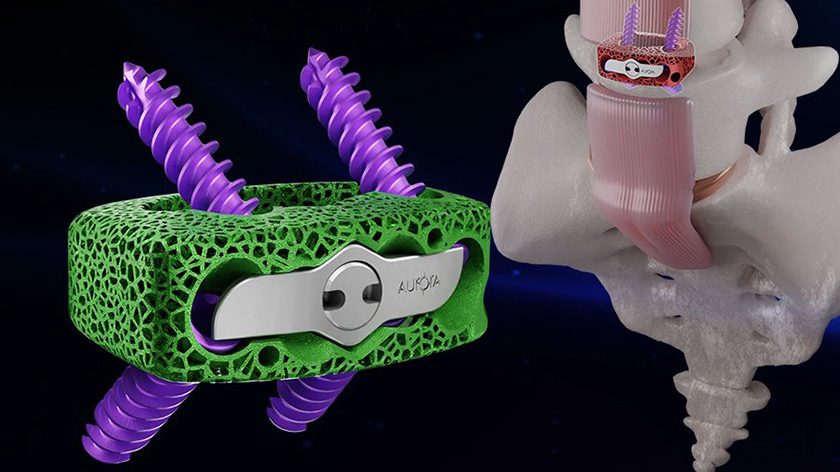Aurora Spine DEXA-L