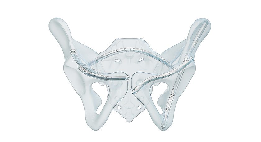 CurvaFix Low Profile System