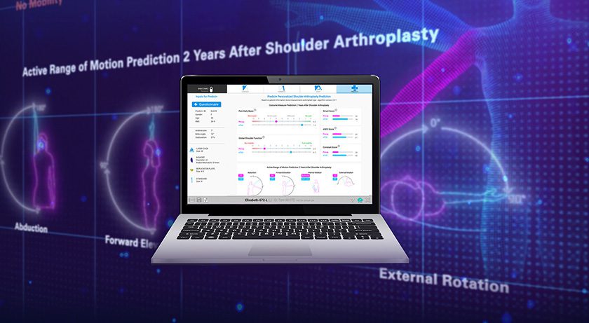 Exactech Large Scale CT Radiomic Analysis