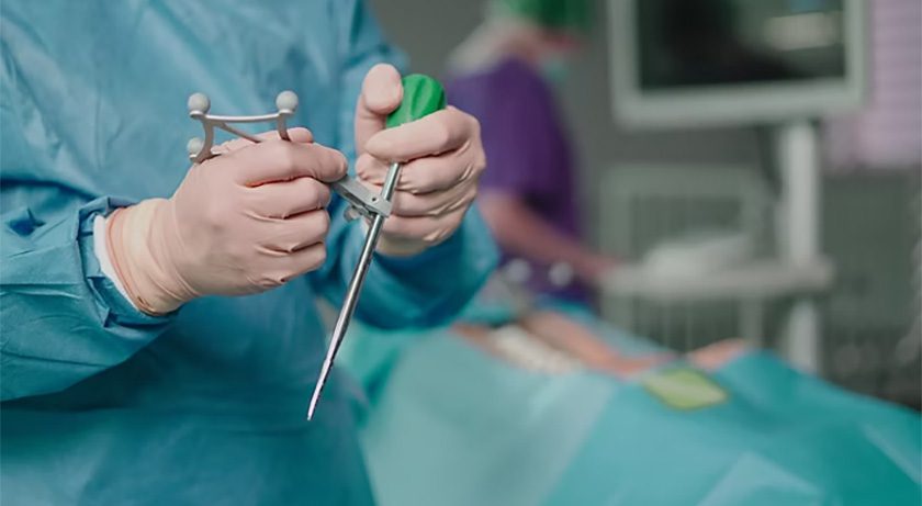 PathKeeper Surgical Navigation