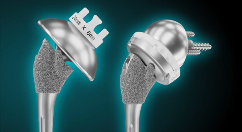 Shoulder Innovations Inset 70 Humeral Stem