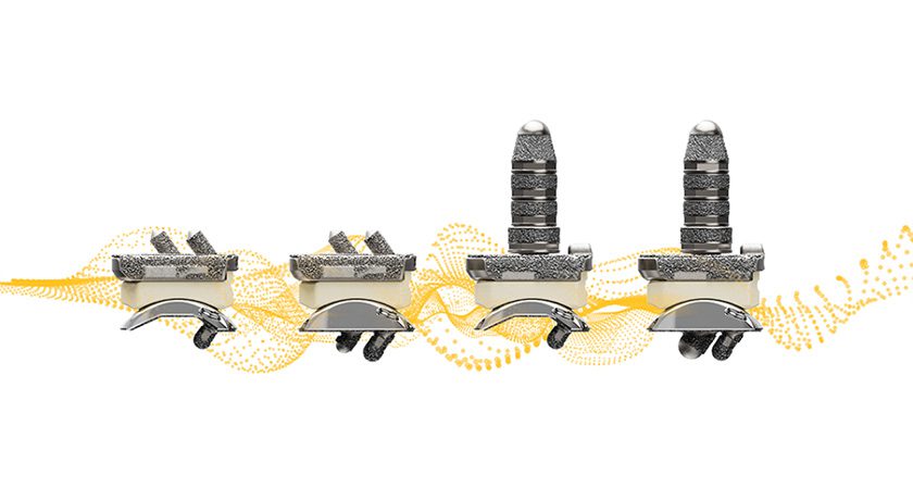 Stryker Incompass Total Ankle