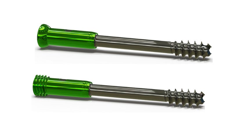 University of Utah Orthopaedic Innovation Center Dynamic Compression Implant