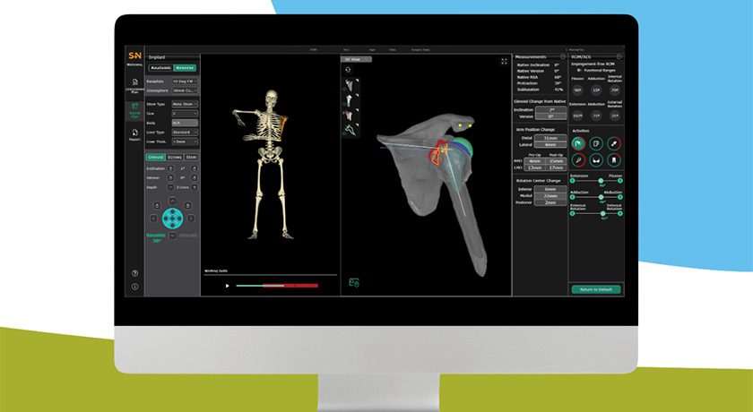 Smith+Nephew CORIOGRAPH