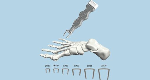 Spartan Medical Clench System