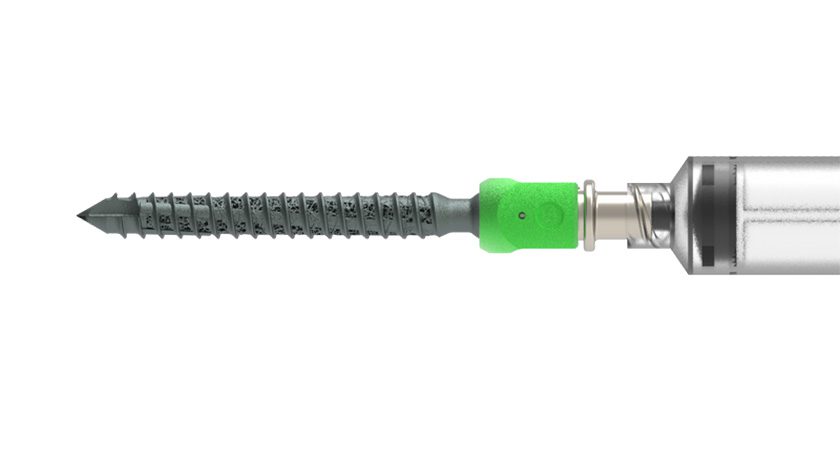 ALLUMIN8 A8-INTEGR8 Pedicle Screw
