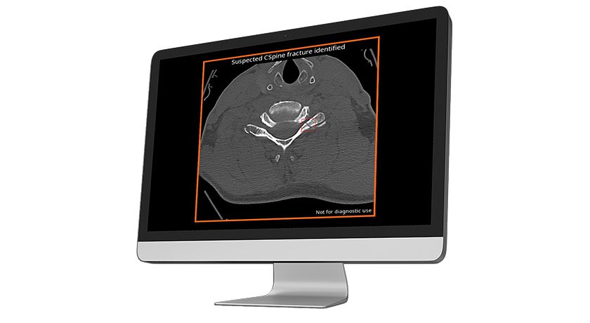 Avicenna.AI Launches AVI Platform For Medical Imaging AI