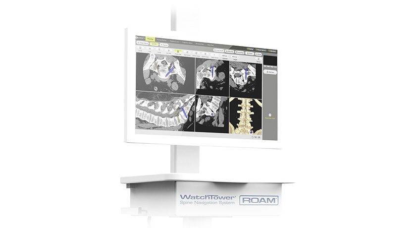 Captiva Spine Watchtower Spine Navigation