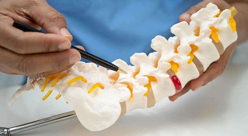 Spine Wave Announces Initial Surgical Procedures with the Testa TP Pivoting Spacer