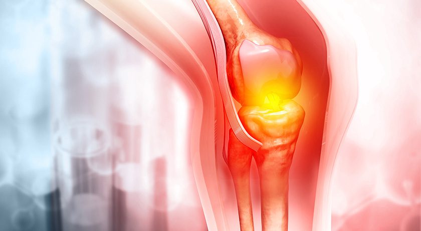 restor3d Announces First Clinical Cases of the iTotal Identity™ CR 3DP Porous Fully Personalized Total Knee