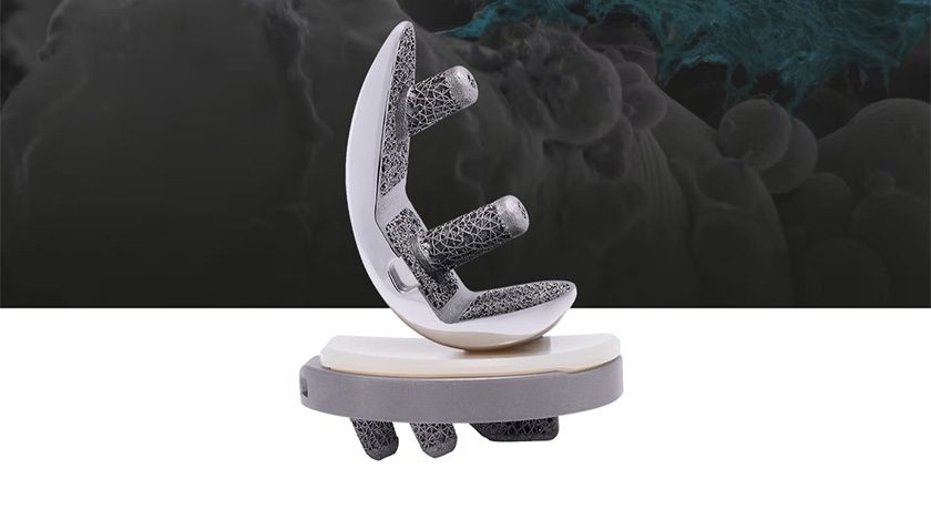 OSSTEC ASCENT Cementless Partial Knee