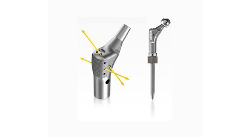 Onkos Surgical ELEOS Limb Salvage