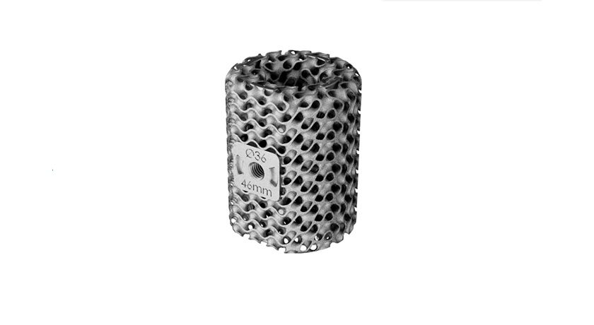 restor3d Ossera AFX Ankle Fusion Cage
