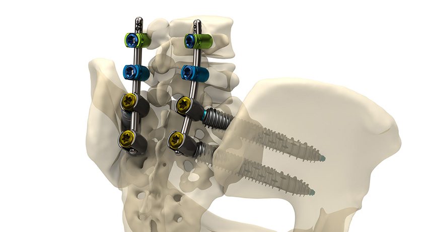 Genesys Spine SIros X