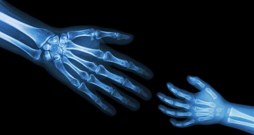 pediatric orthopedics