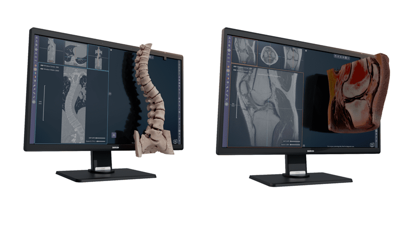 Avatar Medical Vision