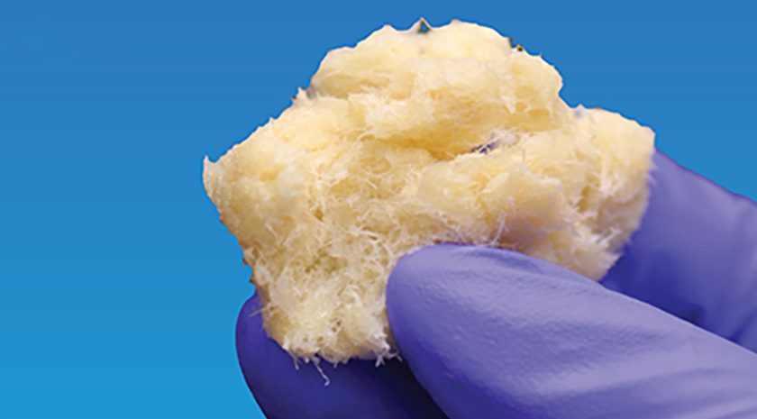 MTF Biologics and Kolosis BIO DBX Fiber