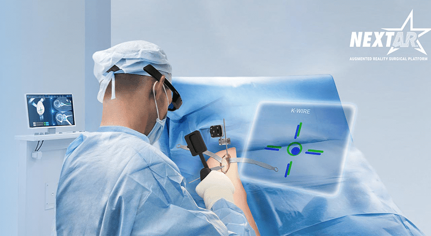 Medacta NextAR Shoulder