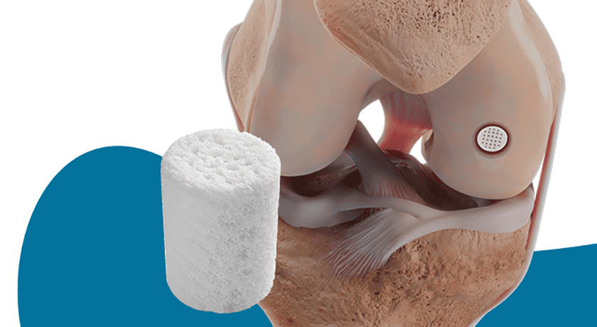 Smith + Nephew CARTIHEAL AGILI-C