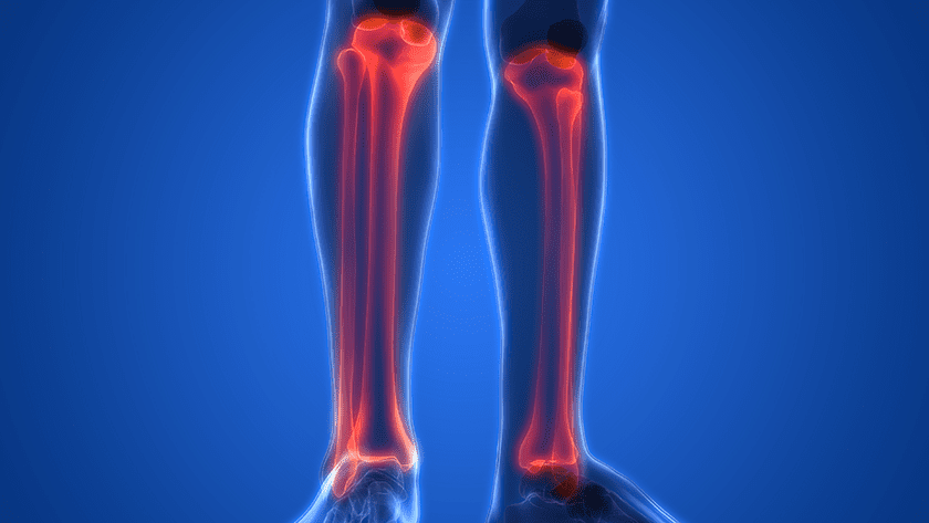 MedCAD's AccuStride Receives FDA 510(k) Clearance for New Anatomical Lower Leg Region Tib/Fib Solution