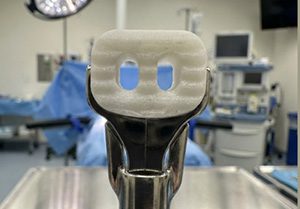 Orthomod MOD-C Cervical Implant