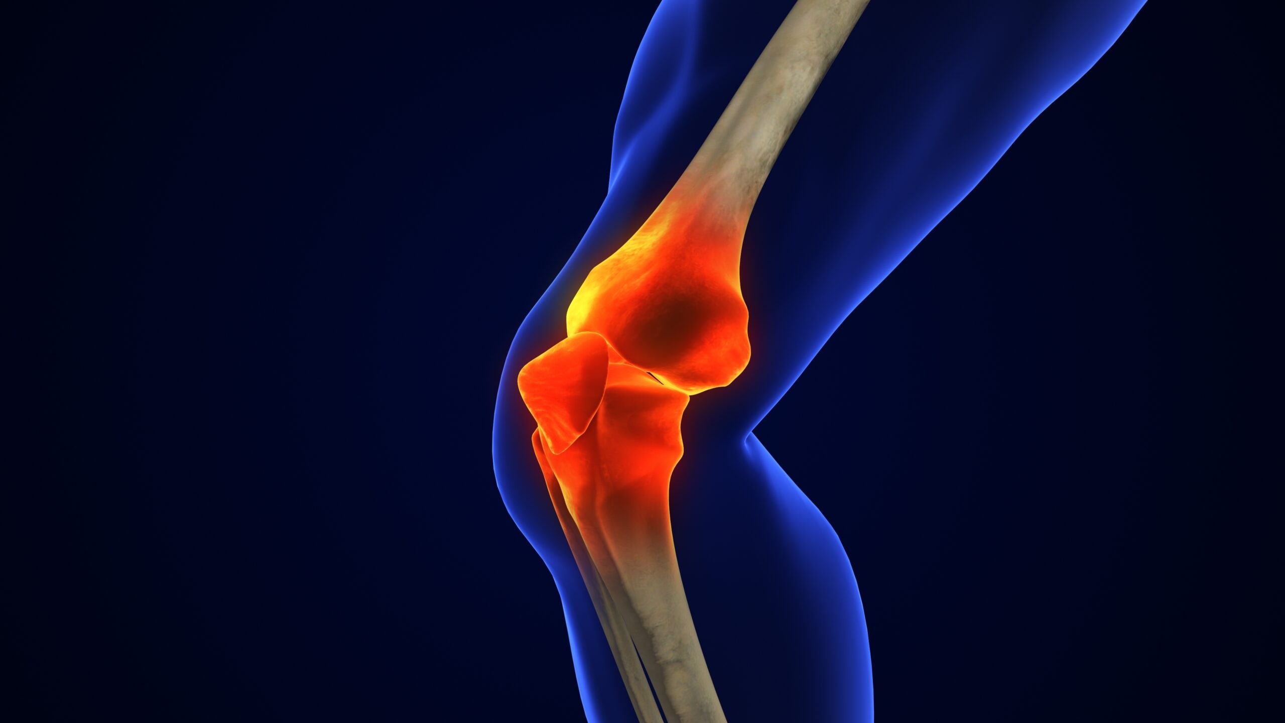 Renovare Therapeutics Launches to Pursue Regenerative OA Therapy