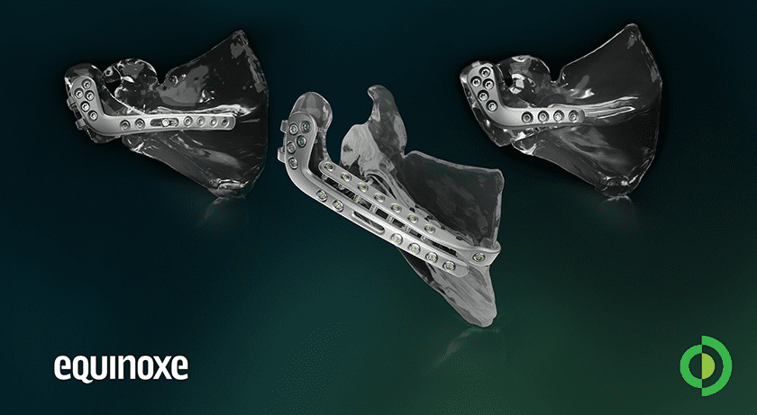 Advita Ortho Equinoxe Scapula Reconstruction