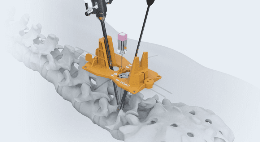 Amplify Surgical dualPortal Approach