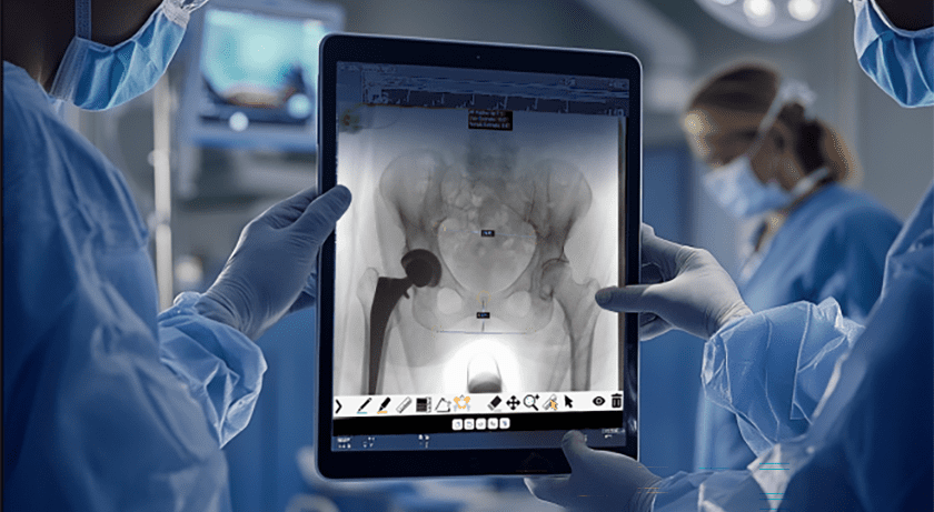 Orthopedic Driven Imaging