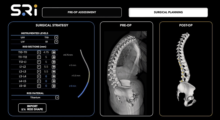Spinal Resources