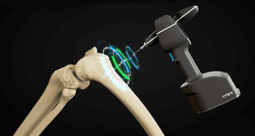 THINK Surgical TMINI Miniature Robot System
