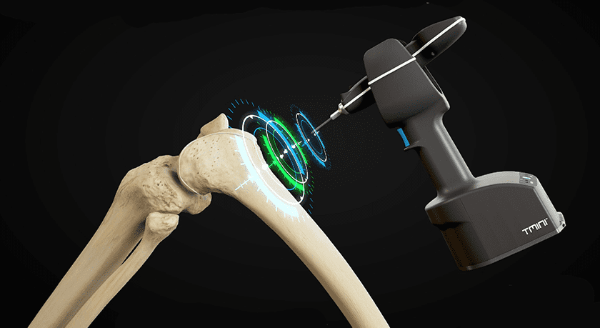 THINK Surgical TMINI Miniature Robot System