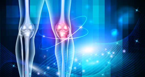 DePuy Synthes Announces Agreement to Acquire Miniature Radiofrequency Tracking Technology
