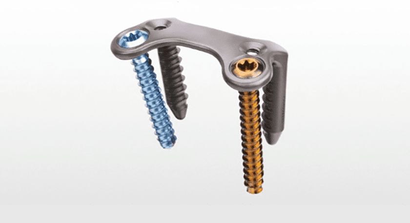 Treace Medical HyperPlate