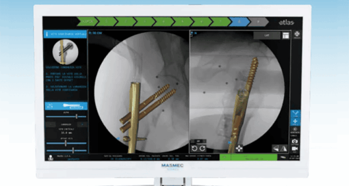 Masmec Biomed Atlas