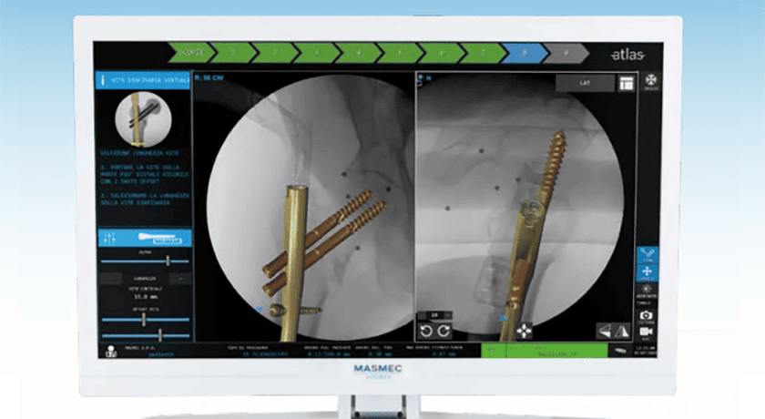 Masmec Biomed Atlas