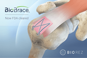 Biorez BioBrace