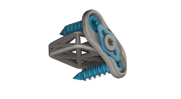 4WEB Cervical Spine Truss System